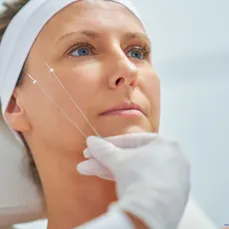 KURS TRÅDLYFT ANSIKTE MED PDO MONO TRÅDAR